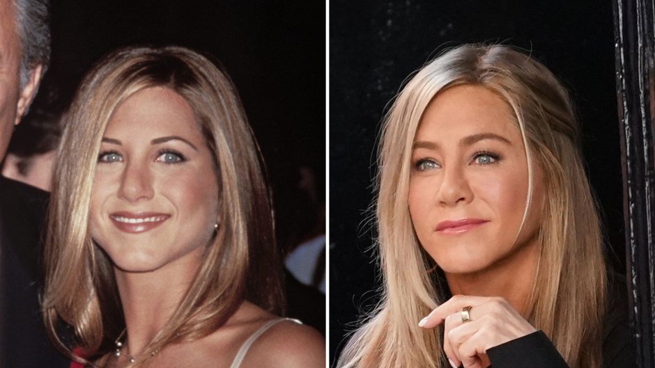 Did Jennifer Aniston Get Plastic Surgery Before After Photos