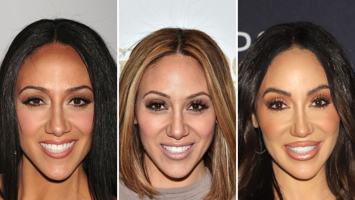 'RHONJ' Star Melissa Gorga Has Undergone Multiple Plastic Surgery Procedures: See Before, After Pics