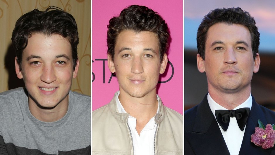 He’s Got the Looks! See Miles Teller’s Transformation Over the Years: Photos Then and Now
