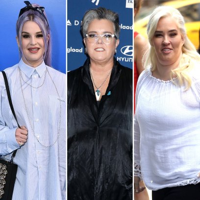 Celebrities Who've Undergone Weight Loss Surgery Gastric Bypasses Liposuction and More