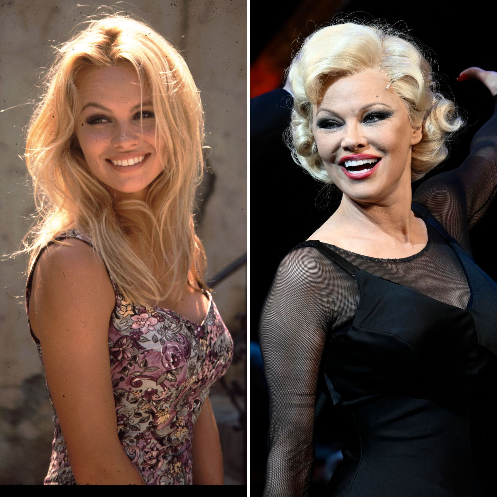 Pamela Anderson Young to Now See the Models Transformation image pic