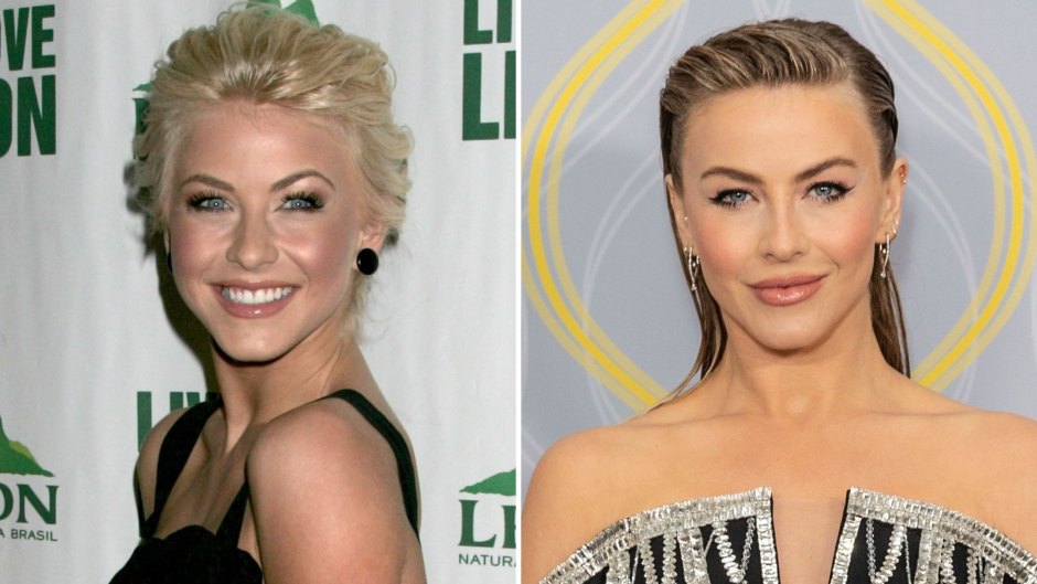 Did Julianne Hough Get Plastic Surgery? Her Transformation Photos
