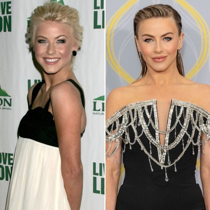 Did Julianne Hough Get Plastic Surgery? Her Transformation Photos