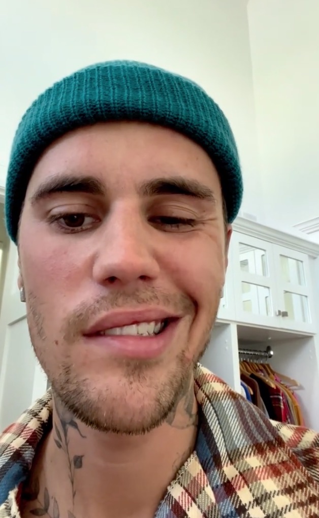 Justin Bieber Medical Syndrome
