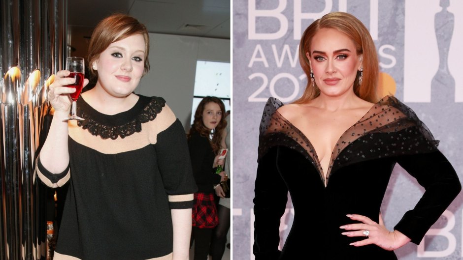 Did Adele Get Plastic Surgery? See Her Transformation Photos Through the Years