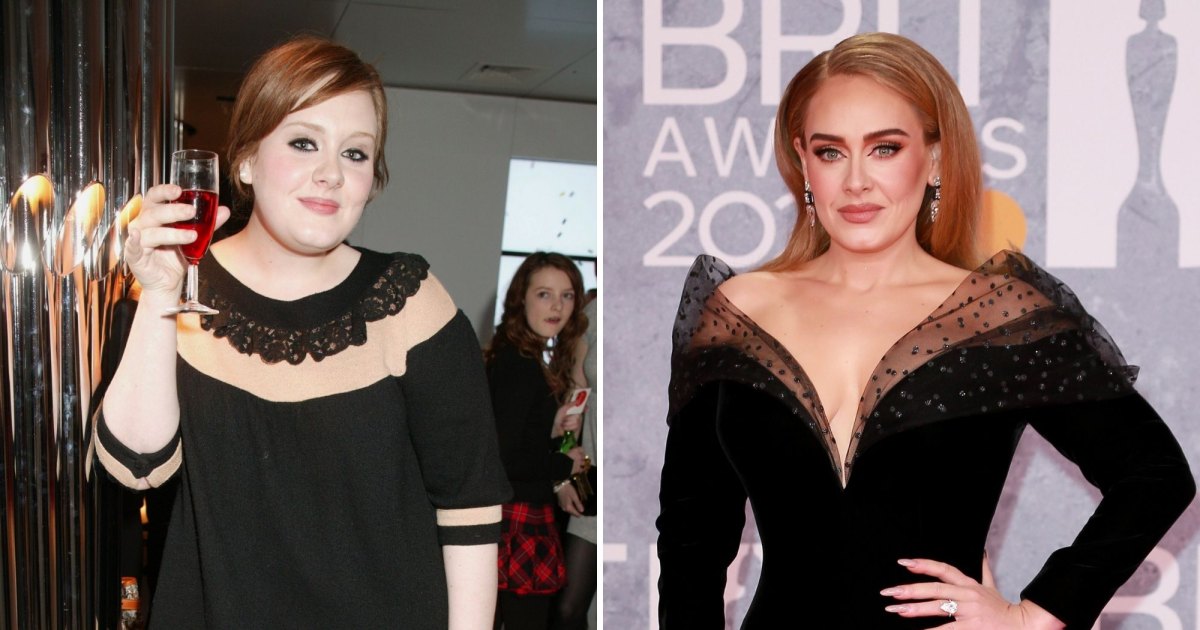 Did Adele Get Plastic Surgery? See Her Transformation Pics