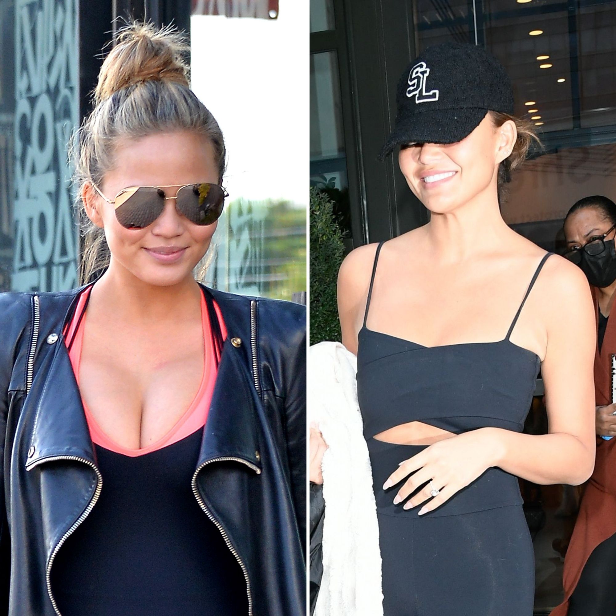 Celebs Who Had Breast Implants Removed: Before, After Photos Chrissy Teigen