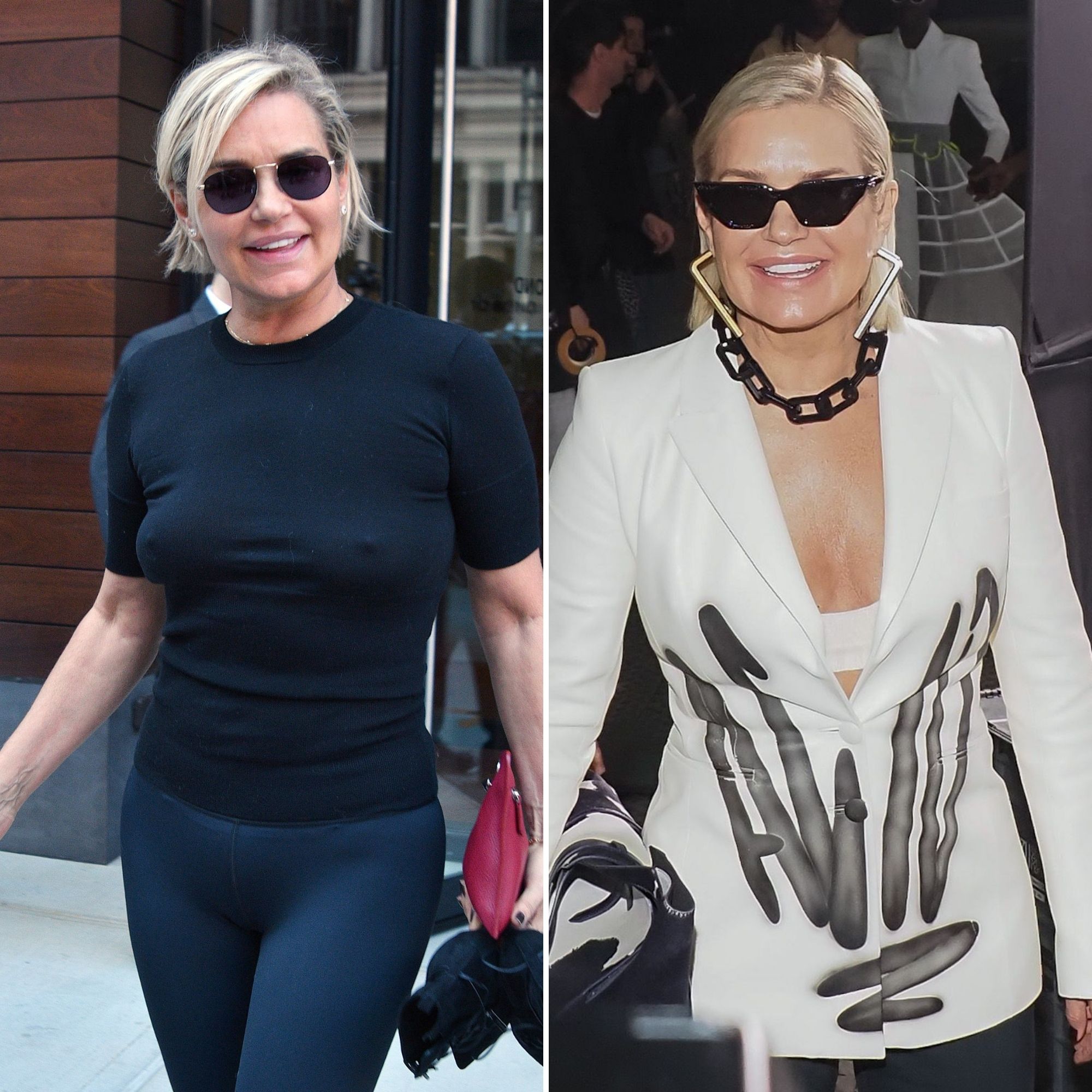 Celebs Who Had Breast Implants Removed: Before, After Photos Yolanda Hadid