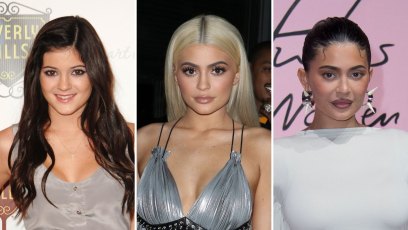 Kylie Jenner Plastic Surgery Before After Photos