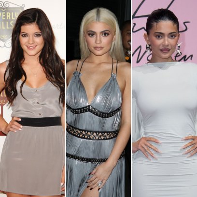 Kylie Jenner Plastic Surgery Before After Photos