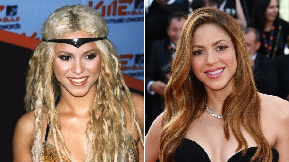 Shakira Plastic Surgery