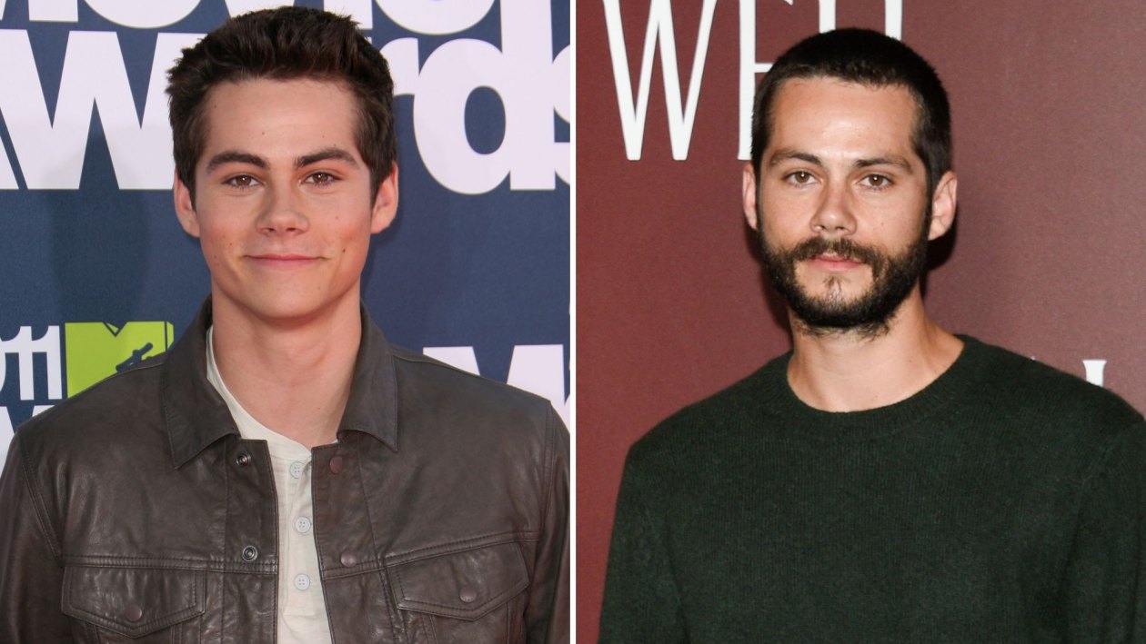 Dylan O'Brien Transformation Pictures: Then vs Now Photos | Life & Style