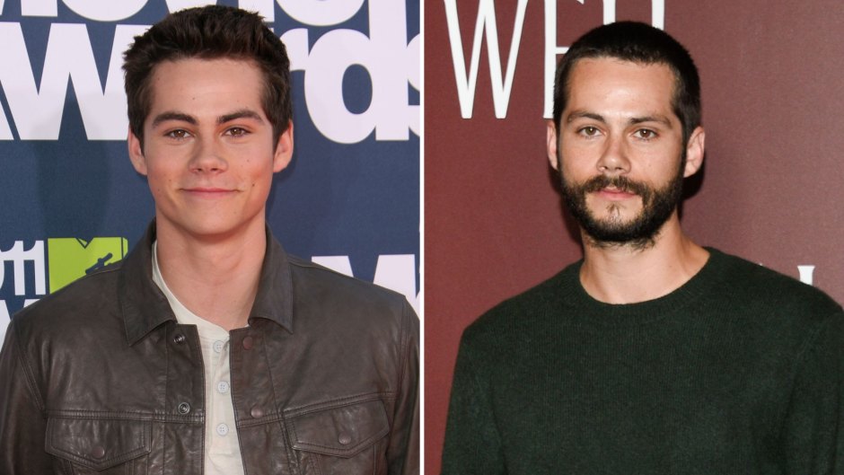We're ~Not OK~ With Dylan O'Brien's Transformation From 'Teen Wolf' to Today: Photos Over the Years