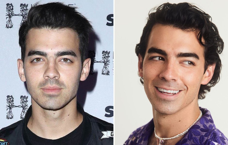 Did Joe Jonas Get Plastic Surgery? See Before-And-After Photos of the Jonas Brother