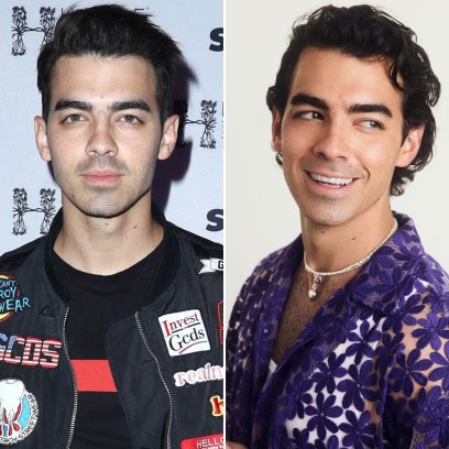 Did Joe Jonas Get Plastic Surgery? See Before-And-After Photos of the Jonas Brother