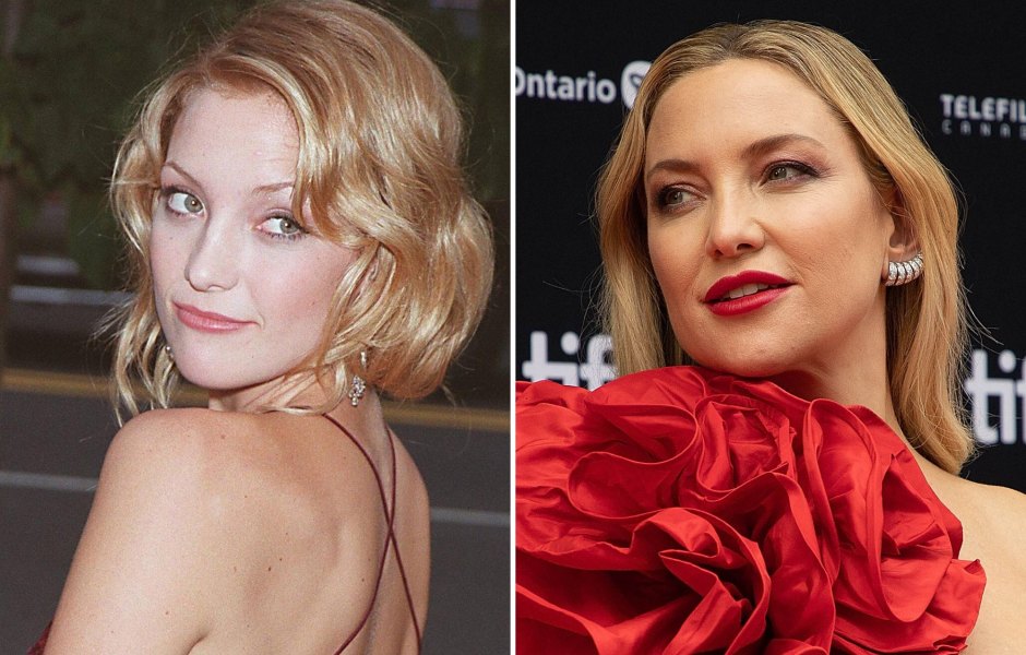Did Kate Hudson Get Plastic Surgery? Transformation Photos