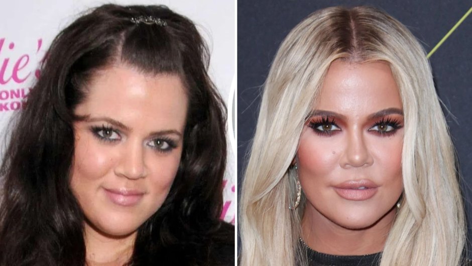 Khloe Kardashian's Plastic Surgery Transformation: Photos