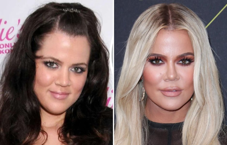 Khloe Kardashian's Plastic Surgery Transformation: Photos