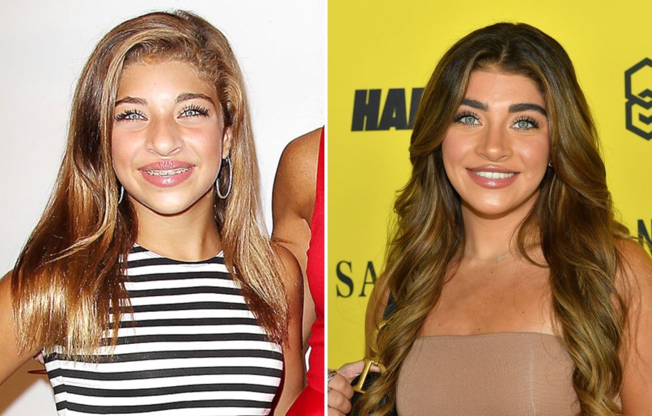 Twenty-Fun! Take a Look at Gia Giudice's Transformation Over the Years After Plastic Surgery