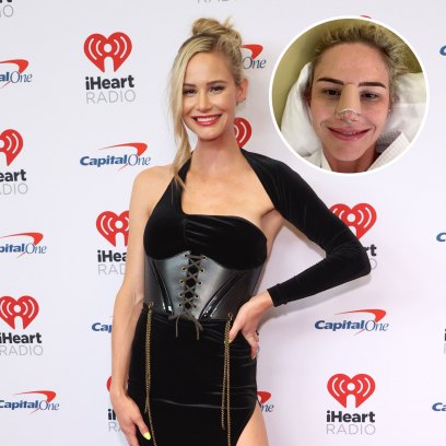 RHOC's Meghan King Documents Plastic Surgery Journey After Selling $5,000 Engagement Ring