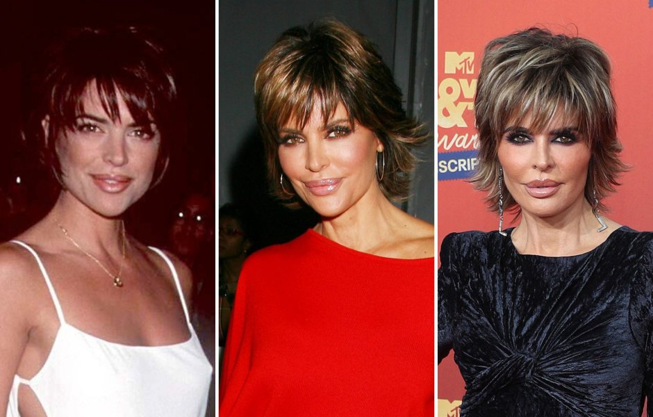 'RHOBH' Star Lisa Rinna Owns Her Plastic Surgery Journey: See Photos of Her Transformation and Quotes