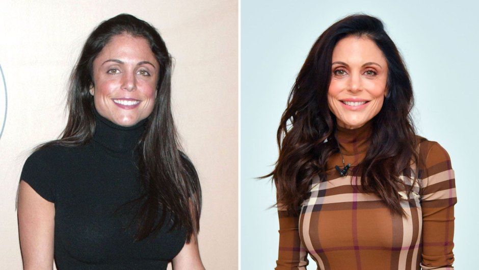 Has Bethenny Frankel Had Plastic Surgery? The Former 'RHONY' Star Details Past Procedures