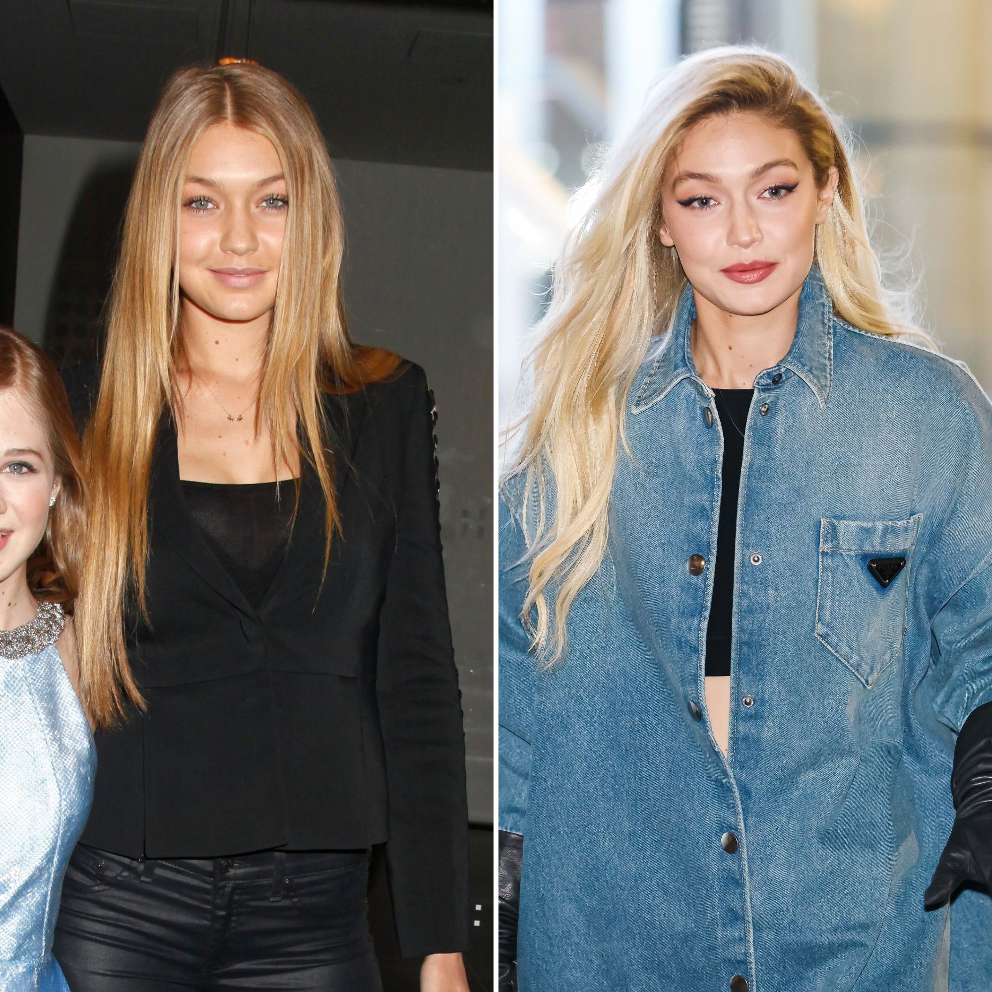 Did Gigi Hadid Get Plastic Surgery? Her Transformation Explained