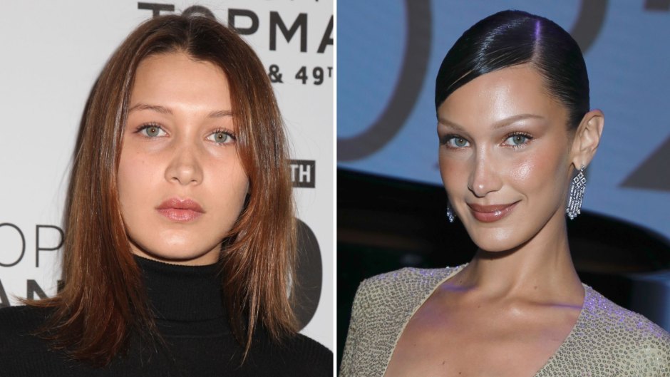 Did Bella Hadid Get Plastic Surgery? Transformation Photos