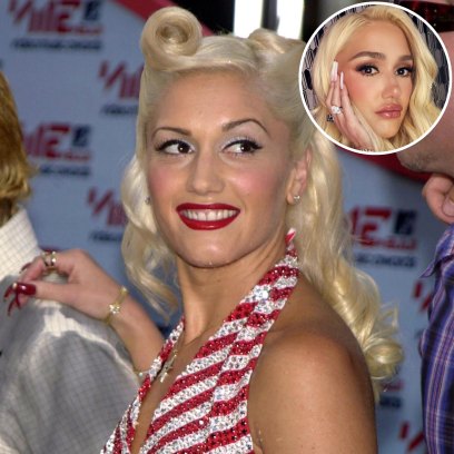 Has Gwen Stefani Had Plastic Surgery? See Her Transformation Photos