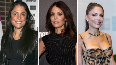 Bethenny Frankel Plastic Surgery: Transformation Photos
