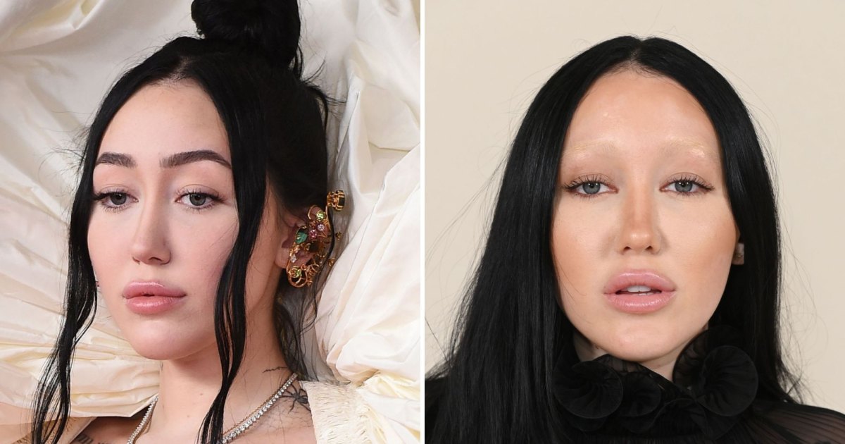 Celebrities With Bleached Eyebrows: Before-and-After Photos