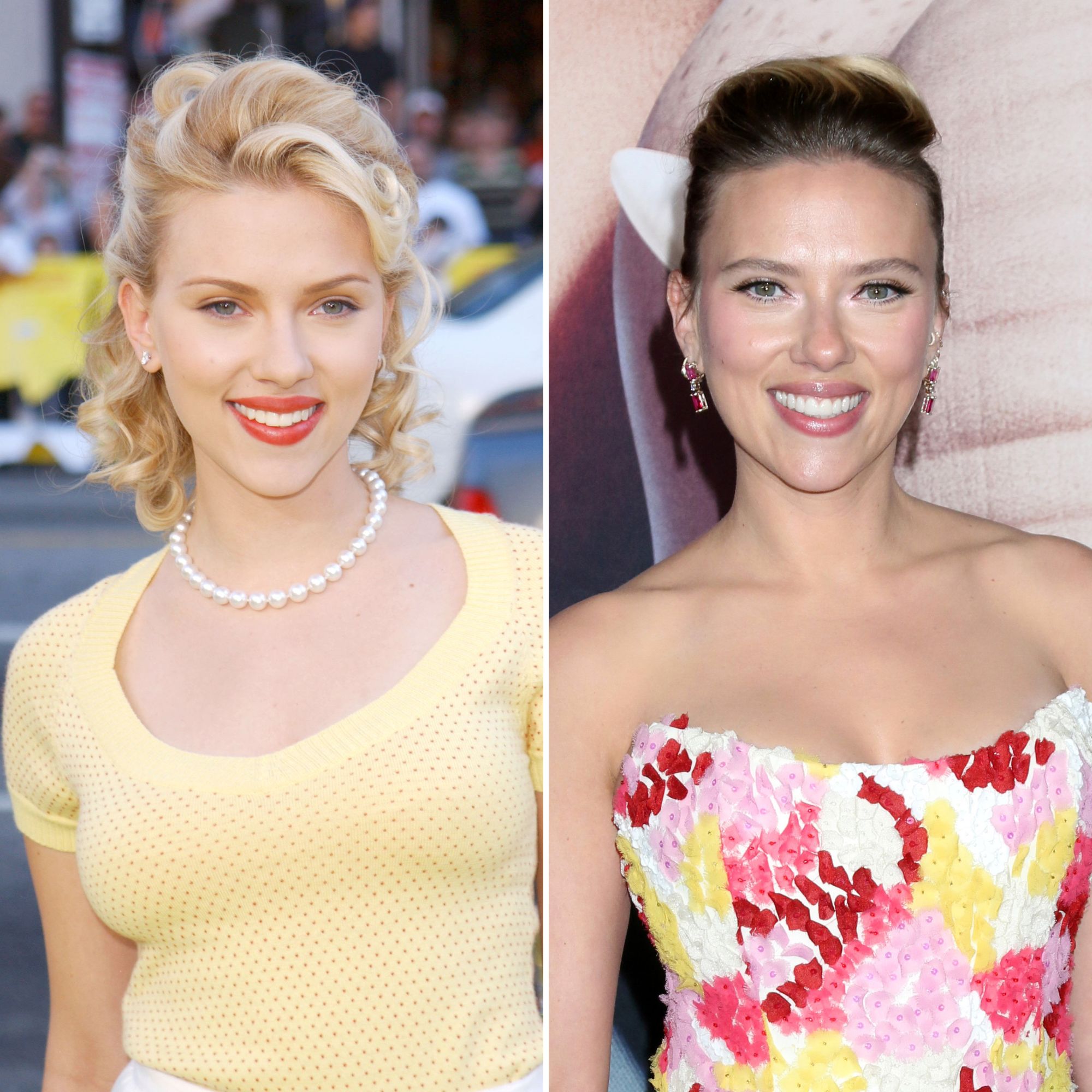 Did Scarlett Johansson Get Plastic Surgery? Then, Now Photos