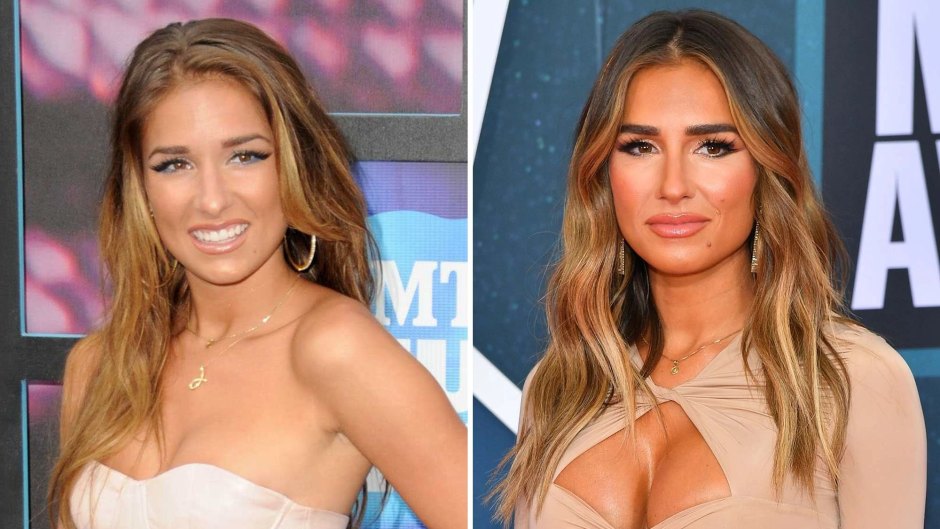 Jessie James Decker's Plastic Surgery: Why She Got a Breast Enhancement and What Else She's Had Done