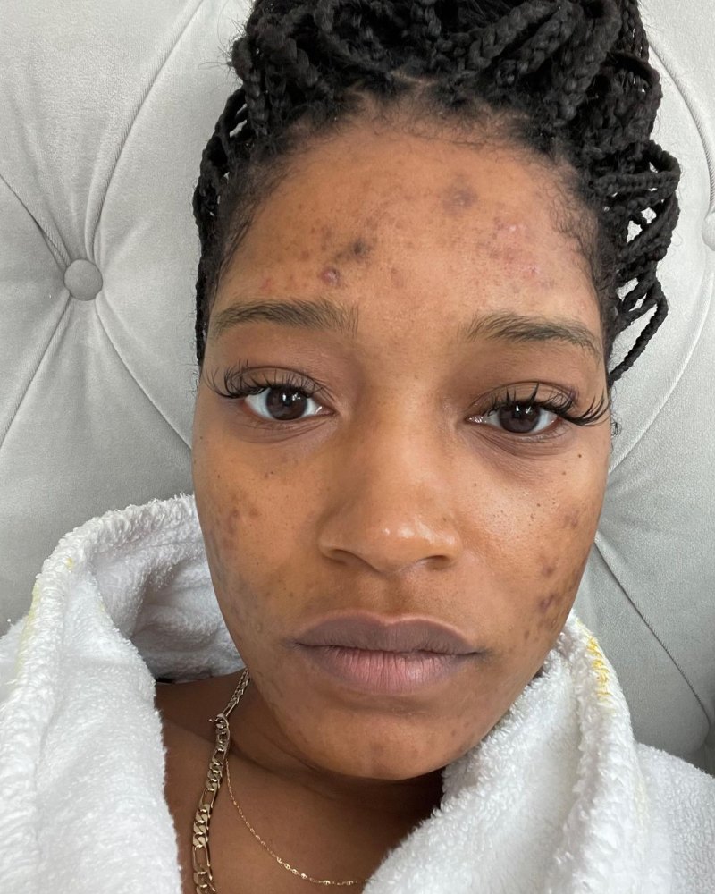 Keke Palmer With No Makeup: Fresh-Faced Photos of the Actress