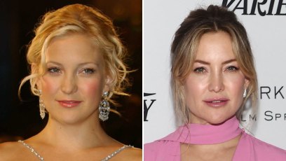 Did Kate Hudson Ever Get Plastic Surgery? See Photos of Her Transformation Over the Years