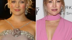 Did Kate Hudson Ever Get Plastic Surgery? See Transformation Photos