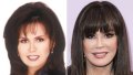 Did Marie Osmond Get Plastic Surgery? Transformation Photos