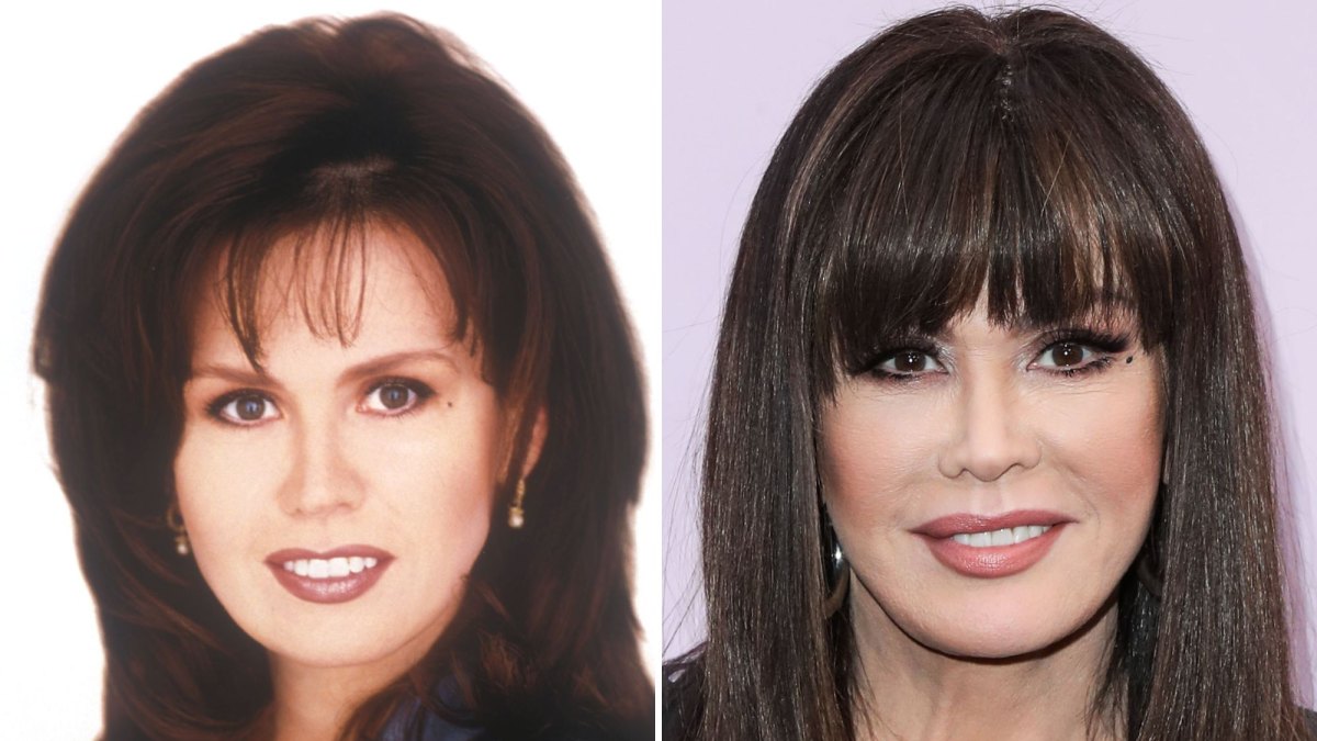 Nude Marie Osmond Tits - Did Marie Osmond Get Plastic Surgery? Transformation Photos