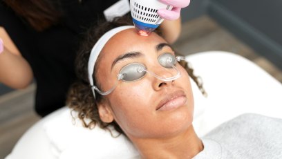 Laser Resurfacing Treatment