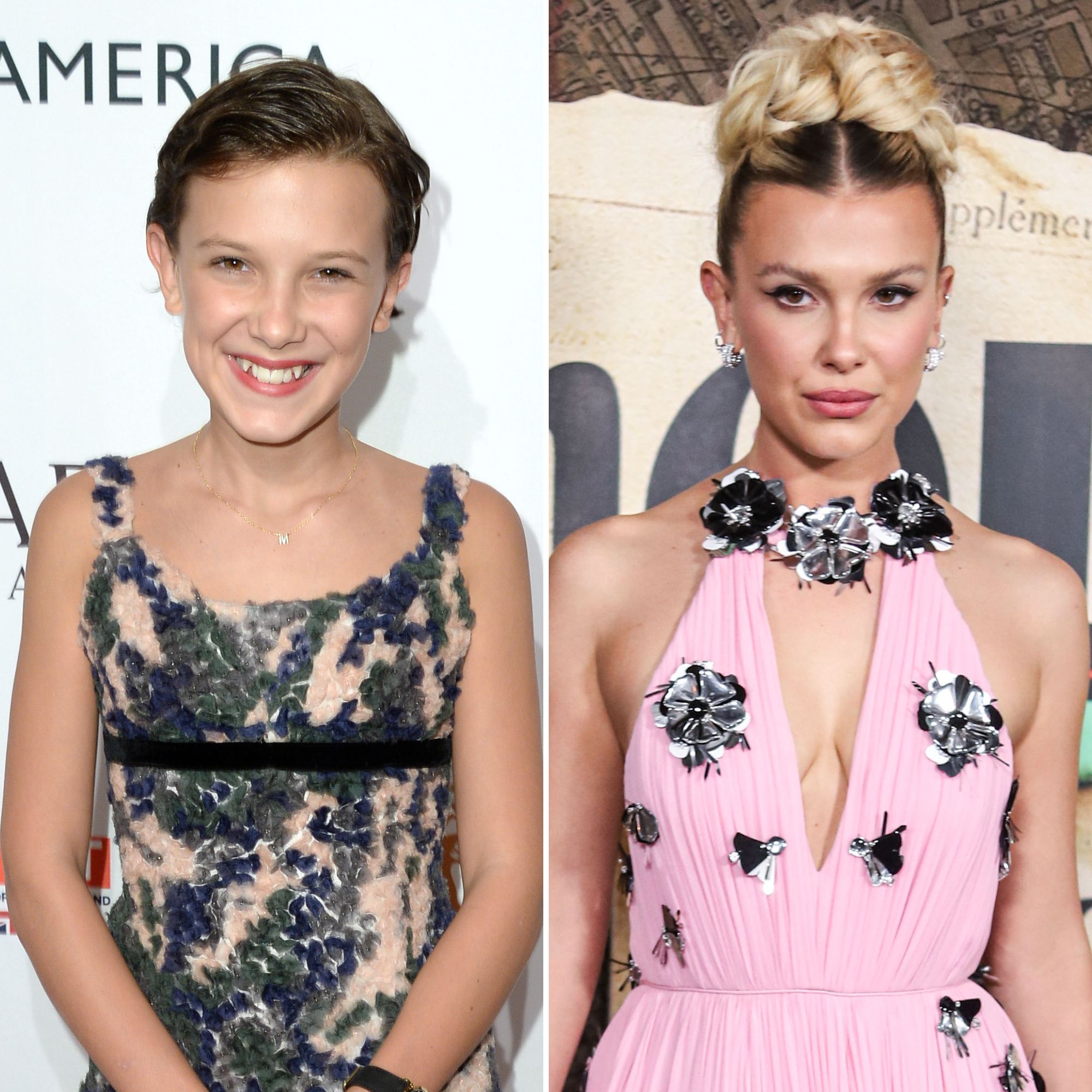 Millie Bobby Brown Plastic Surgery: The Secret Transformation Revealed
