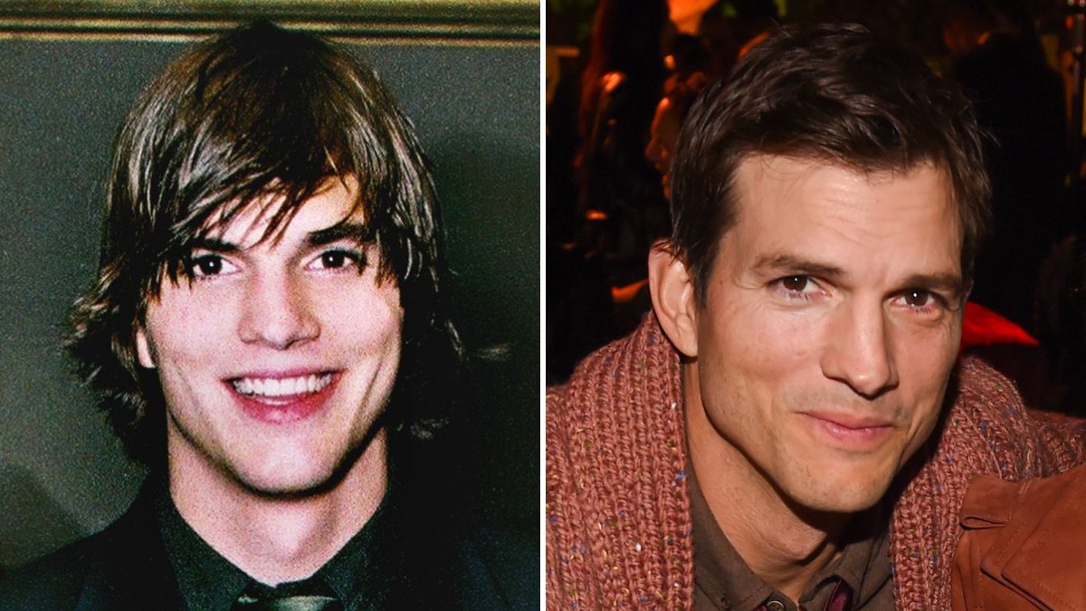 Did Ashton Kutcher Get Plastic Surgery? Quotes, Photos