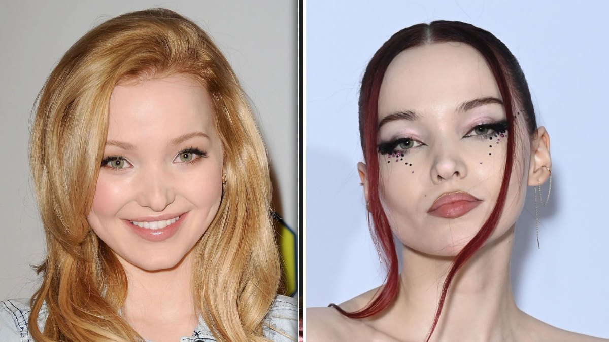 Dove Cameron Has Grown Up in the Public Eye — But Did She Get Plastic Surgery? See Photos