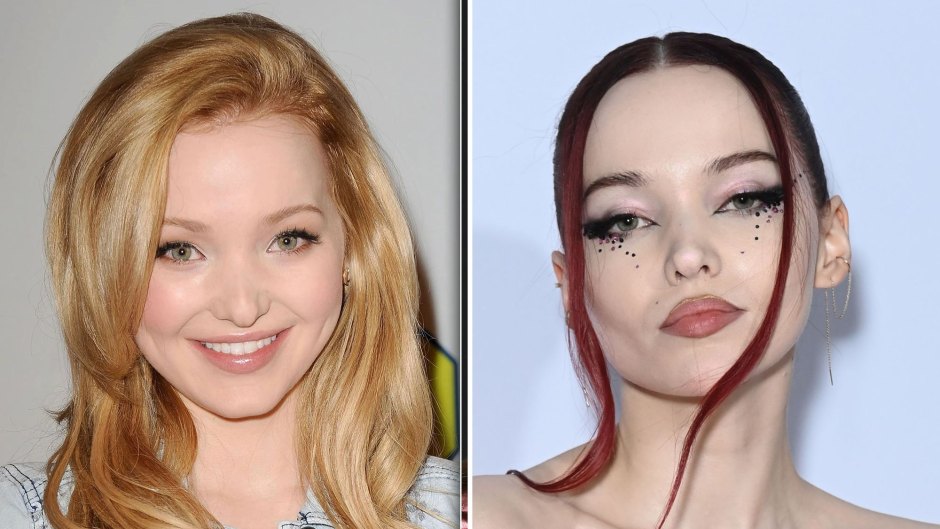 Dove Cameron Has Grown Up in the Public Eye — But Did She Get Plastic Surgery? See Photos