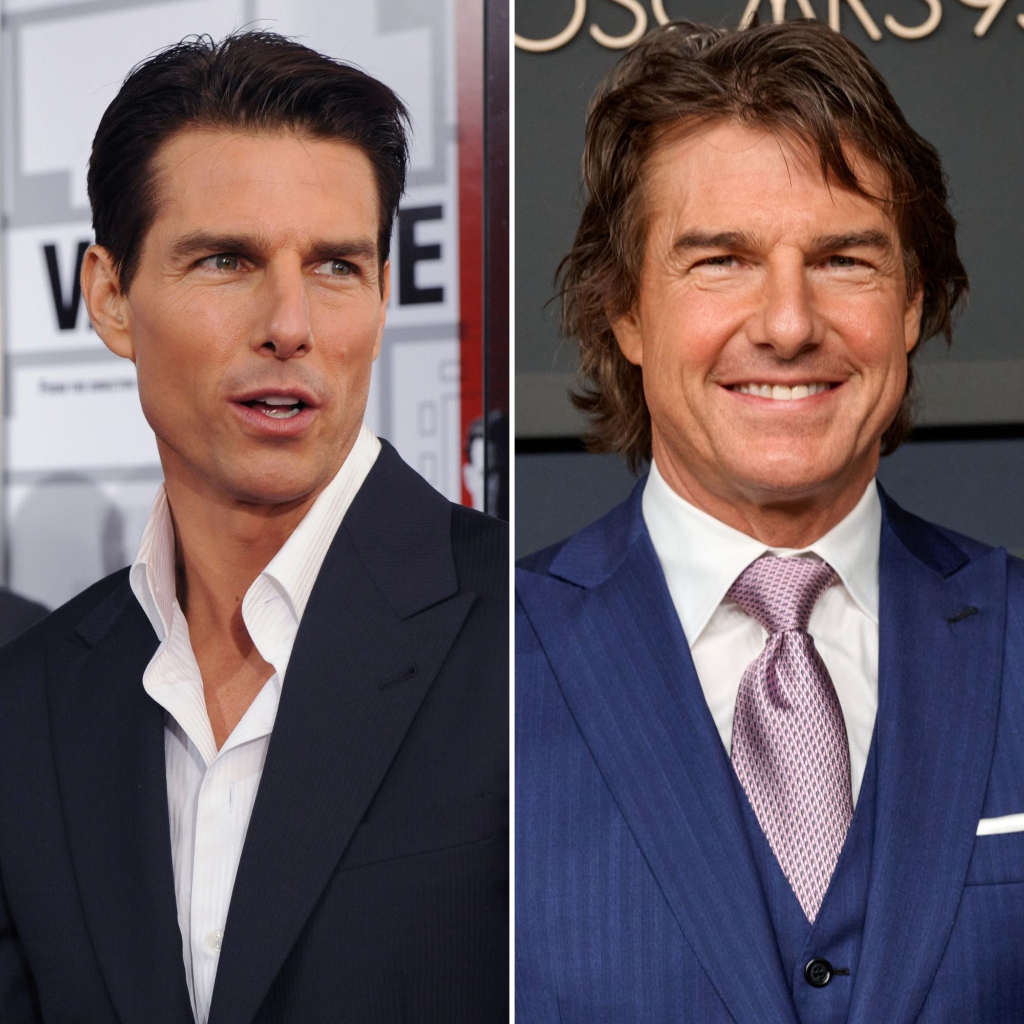 Did Tom Cruise Get Plastic Surgery? Photos of His Transformation
