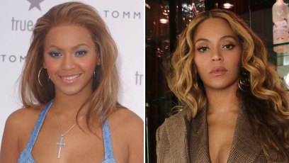 Did Beyonce Get Plastic Surgery? Singer's Transformation Photos