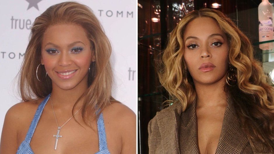 Did Beyonce Get Plastic Surgery? Singer's Transformation Photos