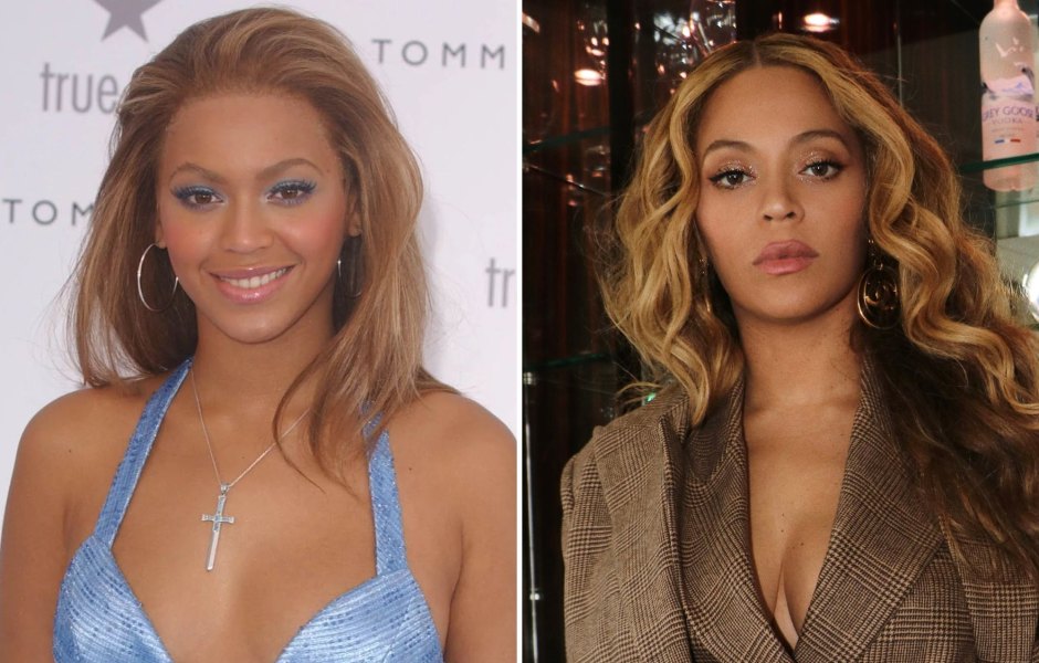 Did Beyonce Get Plastic Surgery? Singer's Transformation Photos