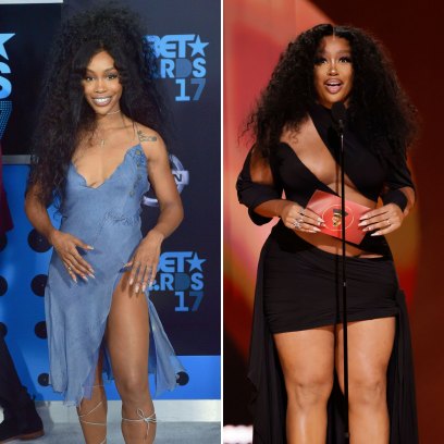 Did SZA Get Plastic Surgery? Transformation Photos, Quotes