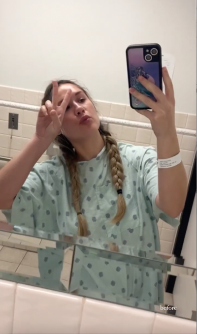Bachelorette Rachel Recchia Surgery: Breast Reduction Photos