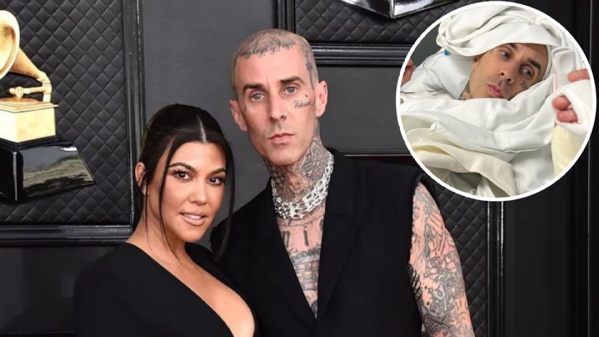 Travis Barker surgery